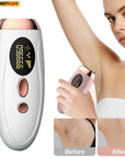 Laser Epilator IPL Hair Removal For Women